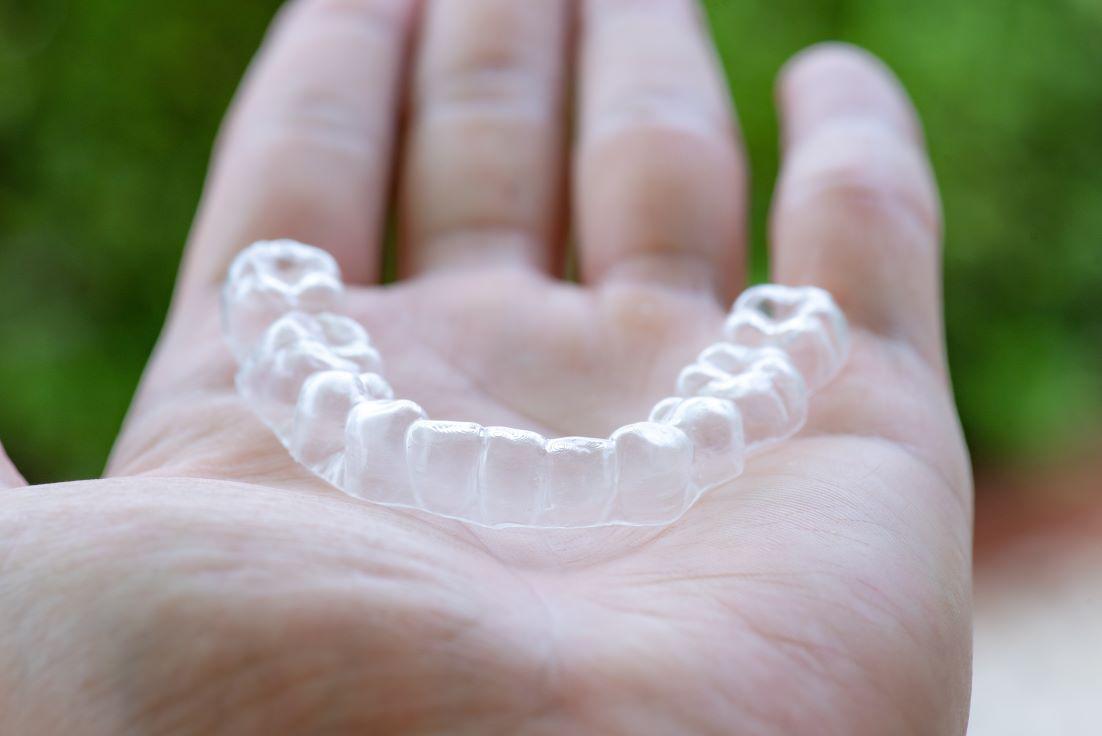What Happens if Your Skip Wearing Clear Aligners?